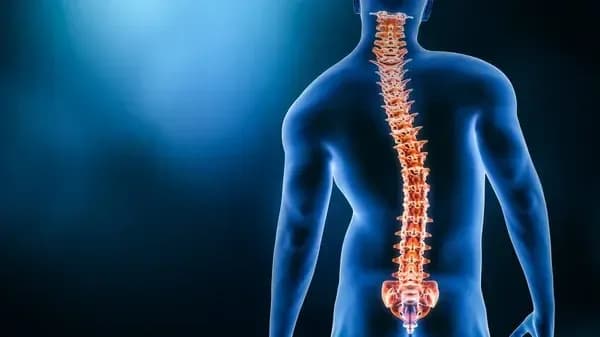 Escoliosis: ¿Tiene tratamiento? Cómo detectarla y tratarla a tiempo